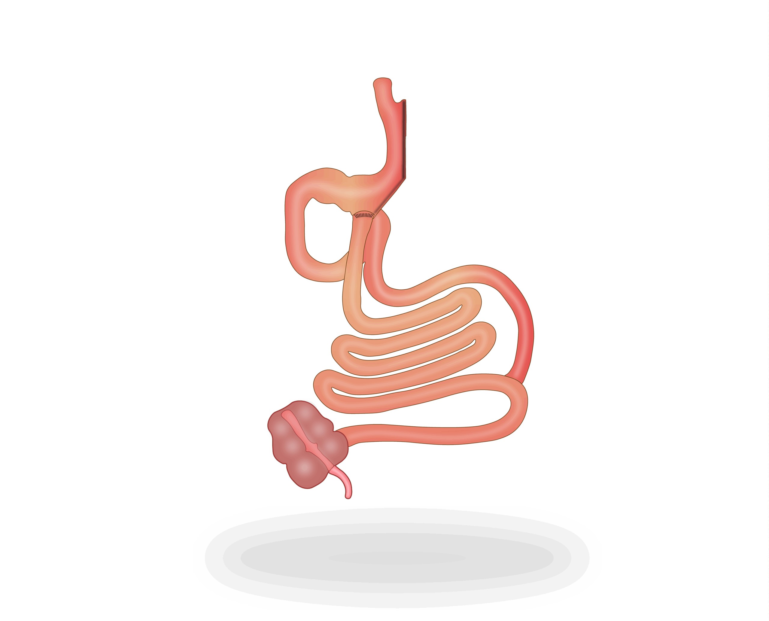 dv_laparoscopia_05
