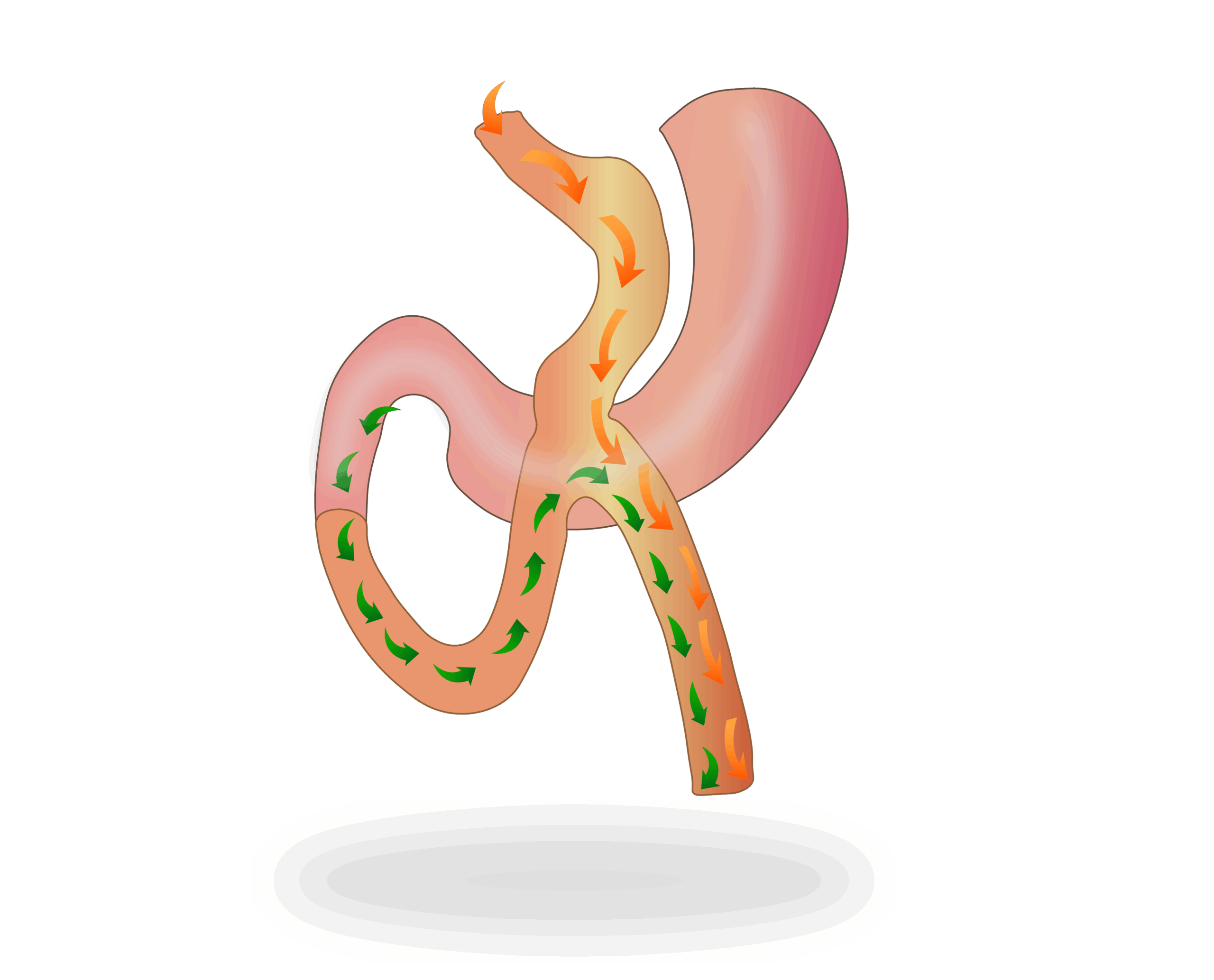 dv_laparoscopia_06